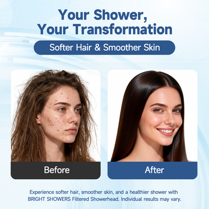 Filtered Shower Head with Handheld, High Pressure 9-Spray Showerhead with Hose and Bracket